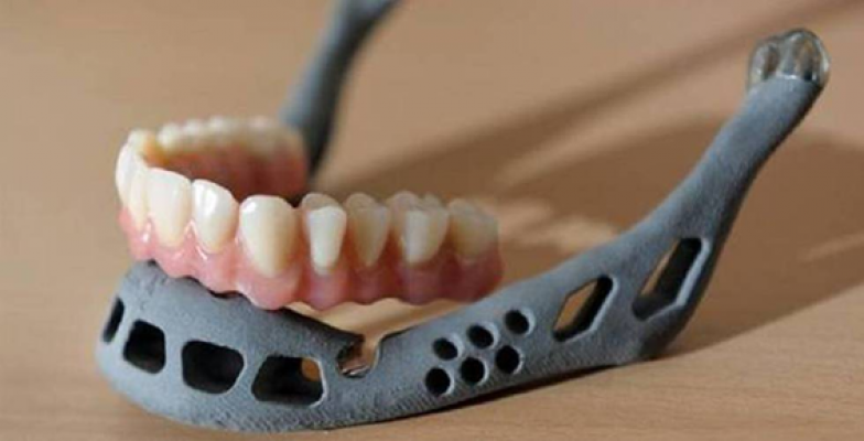 Un niño chino recibe el primer trasplante de una mandíbula creada con una impresora 3D